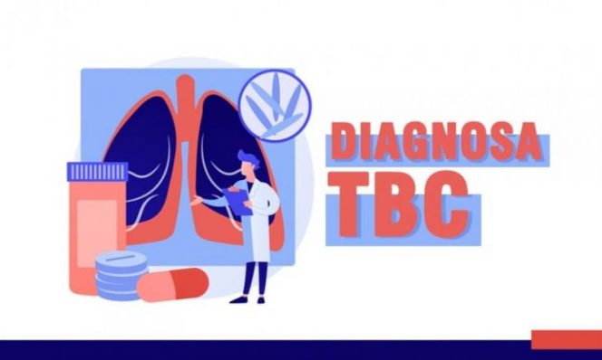 
					Dosen Nusa Mandiri & UBSI Temukan Kenali Diagnosis TBC Sejak Dini
